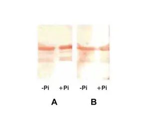 Anti-Cardiac Troponin I antibody [8E10] used in Western Blot (WB). GTX10232